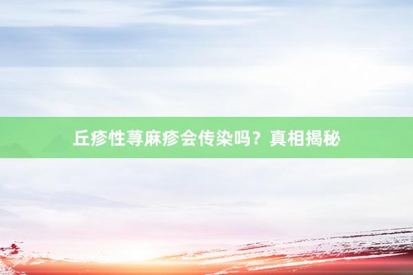 丘疹性荨麻疹会传染吗？真相揭秘